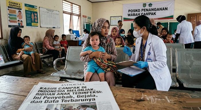 Tips Terhindar dari Kasus Campak di Indonesia Ilustrasi Kasus Campak Meningkat Sumber Mistar ID